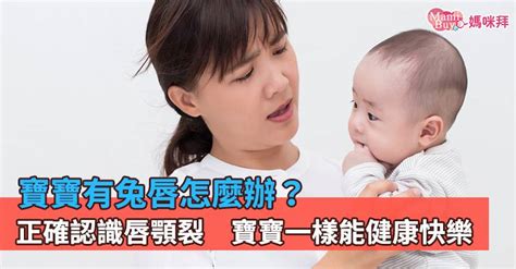 胎兒兔唇|寶寶有兔唇怎麼辦？如何治療？正確認識唇顎裂，寶寶。